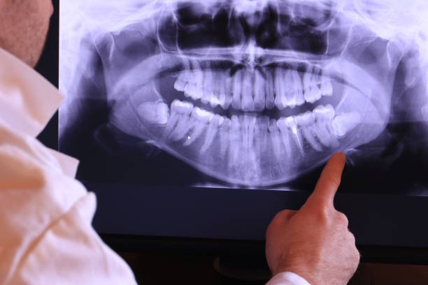 Best Emergency Denture Repair in Jacksonville, OR